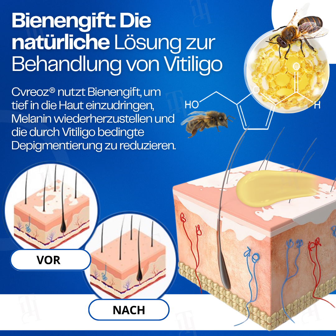 Cvreoz® VitiClear Bienengift Creme