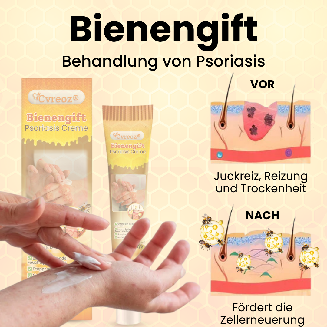 Cvreoz® Bienengift Psoriasis Creme