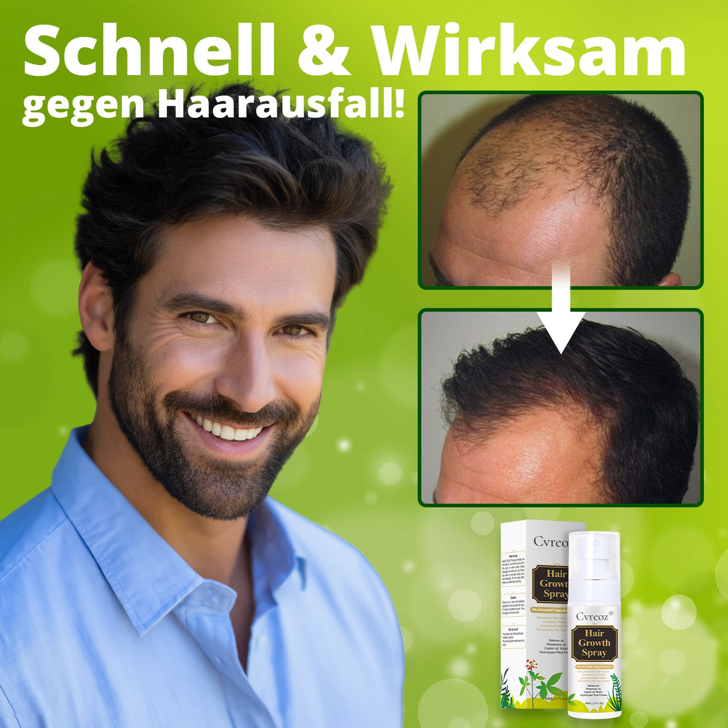 ⓒⓥⓡⓔⓞⓩ® Nourish & Flourish Haarwachstumsspray + 5%Minoxidil