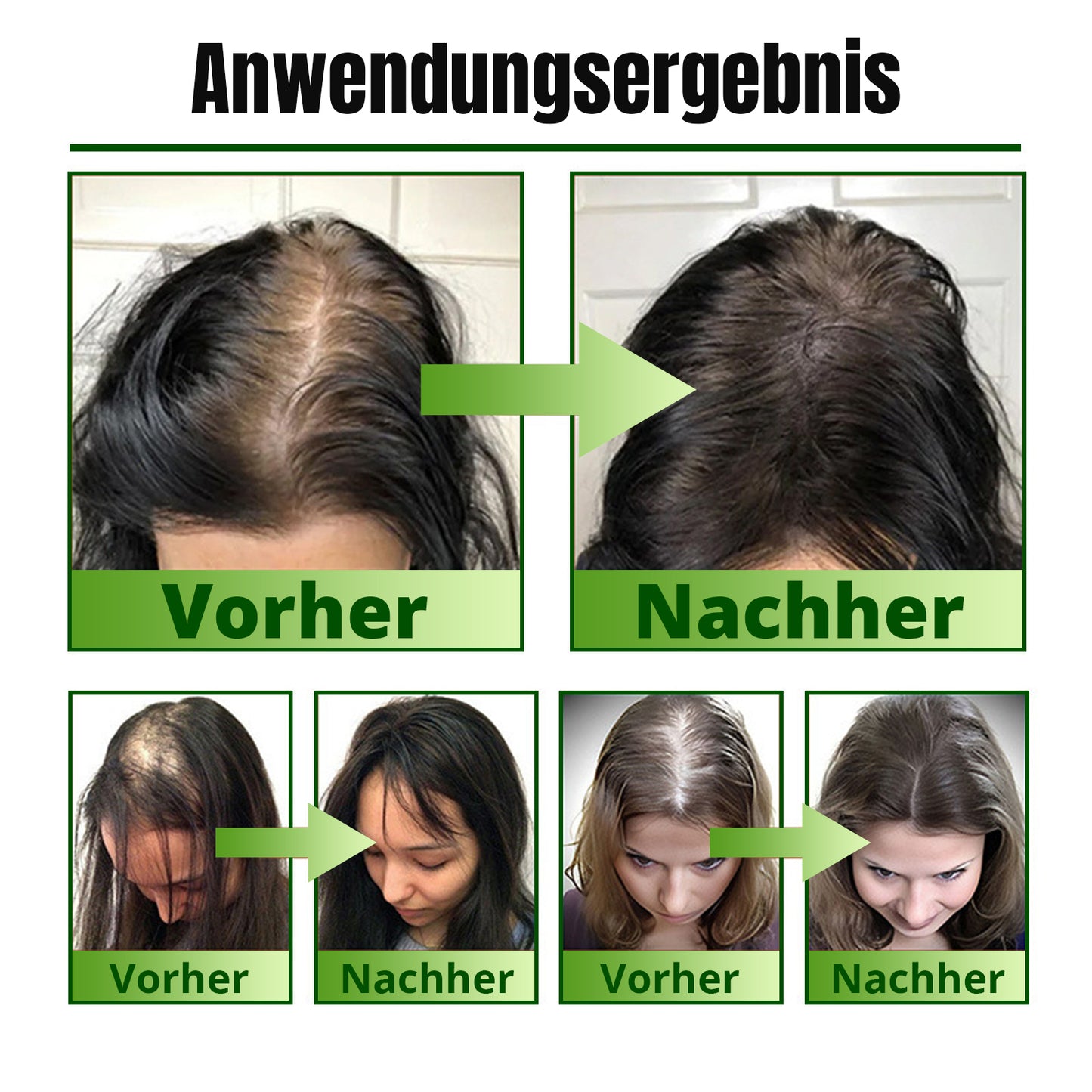 ⓒⓥⓡⓔⓞⓩ® Nourish & Flourish Haarwachstumsspray + 5%Minoxidil