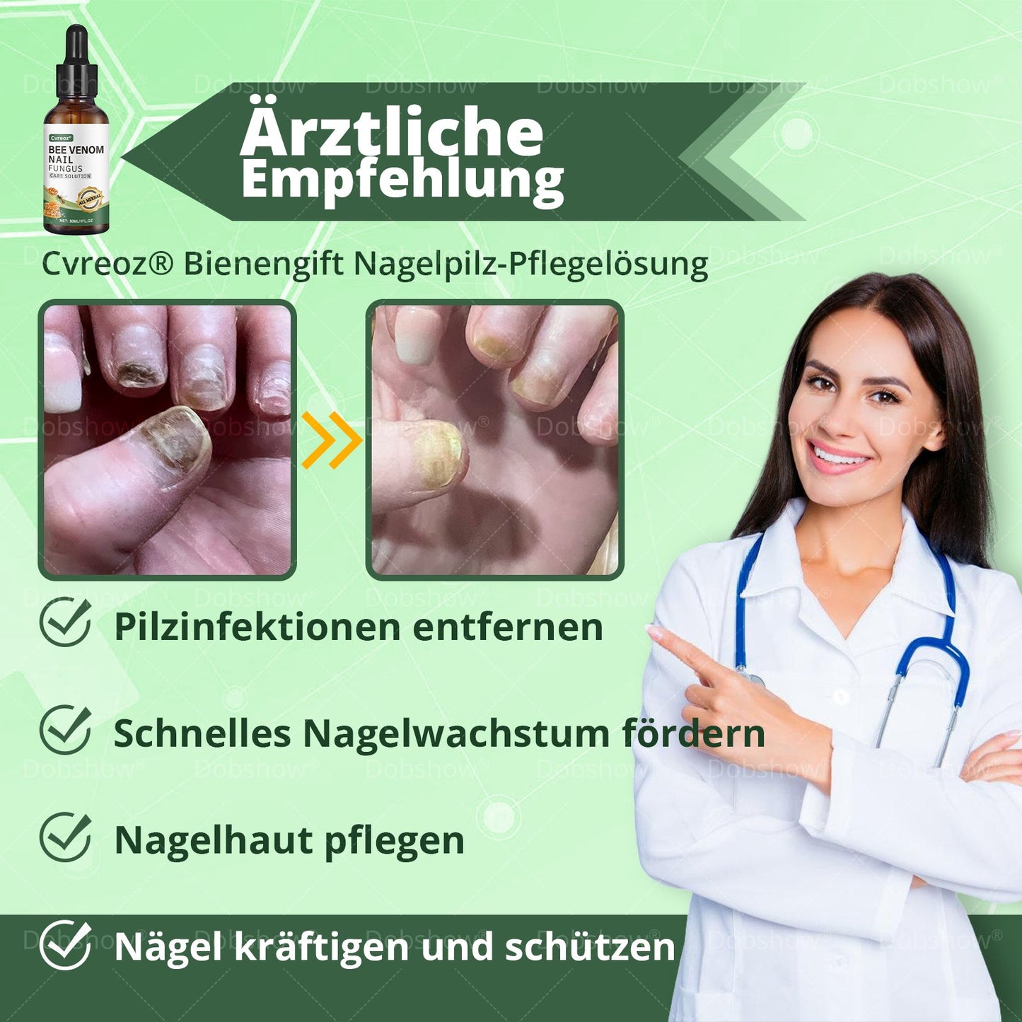 Cvreoz® Bienenvenen Nagelpflege bei Pilzbefall – Natürliche Lösung für gesunde Zehen- und Fingernägel