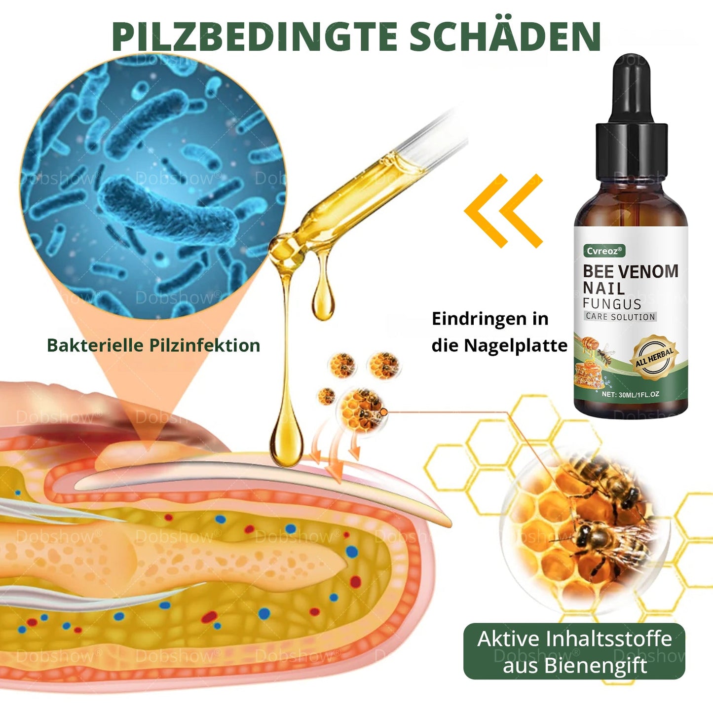 Cvreoz® Bienenvenen Nagelpflege bei Pilzbefall – Natürliche Lösung für gesunde Zehen- und Fingernägel