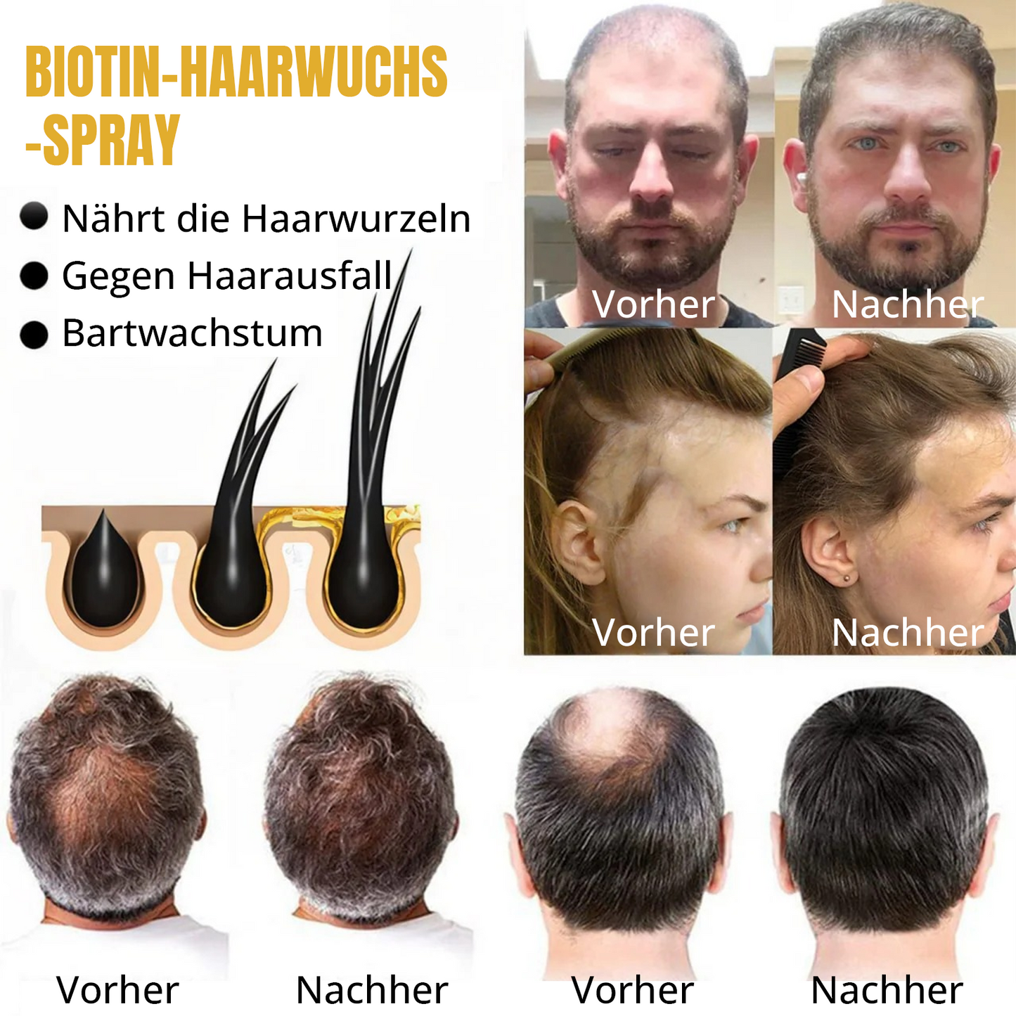 đ„ Lassen Sie Ihren Glanz wachsen: 60 % RABATT đ„ CvreozÂź Biotin-Haaröl (Ă€therisch)! (Jetzt kaufen)