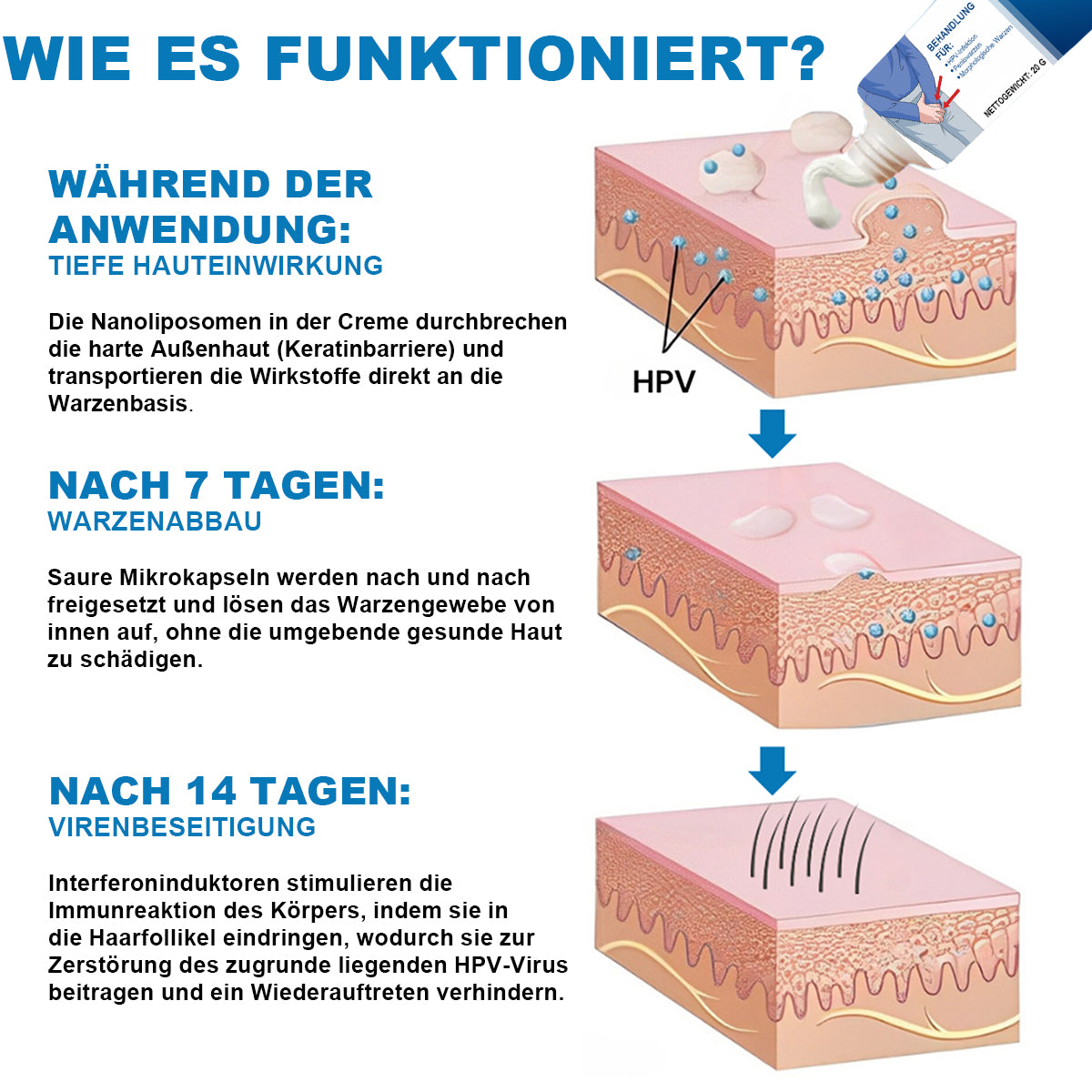 Cvreoz® HPV-Genitalwarzen
