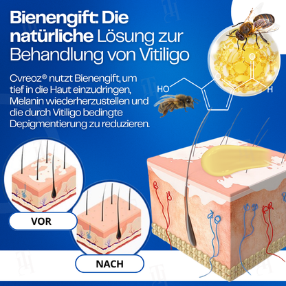 Cvreoz® VitiClear Bienengift Creme