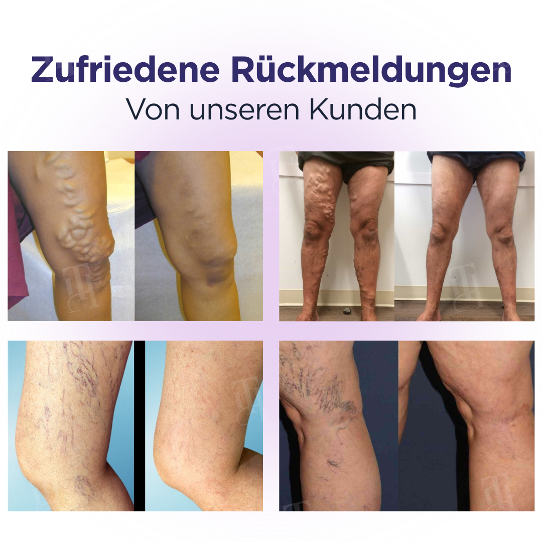 Cvreoz® DiaLeg Pflegecreme