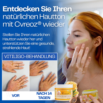 Cvreoz® VitiClear Bienengift Creme