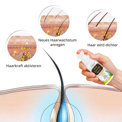 ⓒⓥⓡⓔⓞⓩ® Nourish & Flourish Haarwachstumsspray + 5%Minoxidil