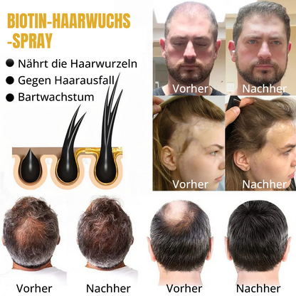 🔥 Lassen Sie Ihren Glanz wachsen: 60 % RABATT 🔥 Cvreoz® Biotin-Haaröl (ätherisch)! (Jetzt kaufen)