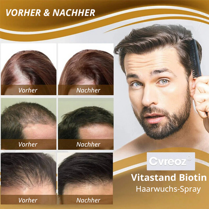 🔥 Lassen Sie Ihren Glanz wachsen: 60 % RABATT 🔥 Cvreoz® Biotin-Haaröl (ätherisch)! (Jetzt kaufen)