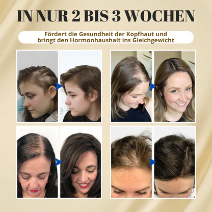 🔥 Lassen Sie Ihren Glanz wachsen: 60 % RABATT 🔥 Cvreoz® Biotin-Haaröl (ätherisch)! (Jetzt kaufen)